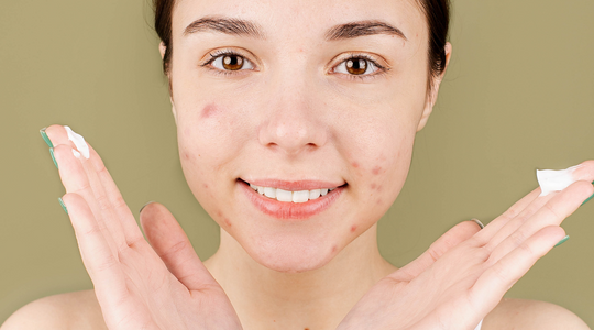 skincare-acne-cleanser